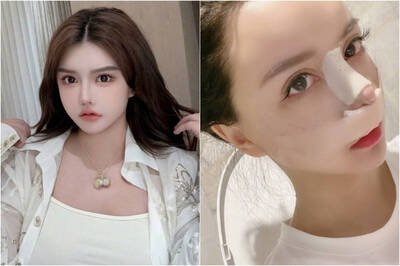 26歲百萬網紅懷孕仍全麻整形 胎兒發育異常不幸流產