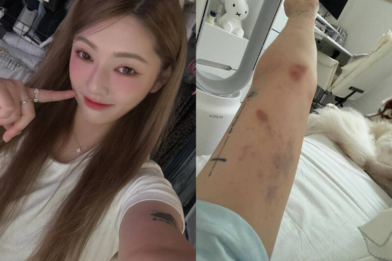 台YTR劉力穎遭韓男毆打 台灣妞提醒:女性旅韓務必保持警覺