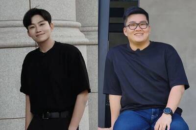 驚！Joeman認做過「8種醫美」…網封「比哀鳳還要猛的升級規格」