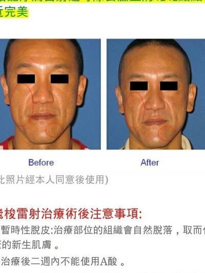 化成灰都認得！ 陳為民醫美照「打馬賽克也沒用」