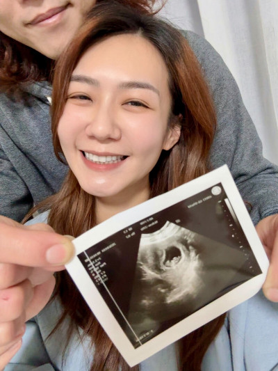 本土劇女神懷孕「性慾激增」羞吐驚人變化   春夢夢見「他」超傻眼