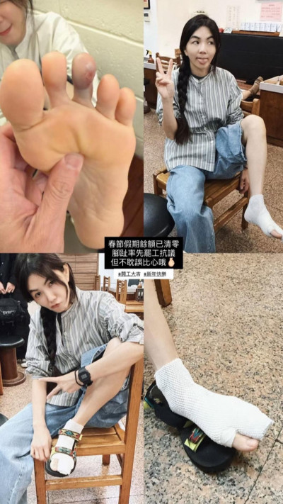 才開工就掛彩！Ella「罷工抗議」就醫畫面曝光