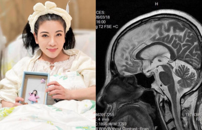 陳文茜抗癌1年傳喜訊！腦部MRI「如藝術品般乾淨」 68歲生日前夕吐心聲