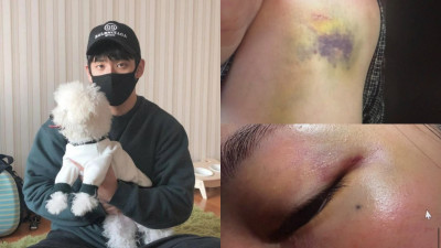 JISOO親哥爆家暴！老婆驚悚傷勢照曝光：被迫吞X硬上後門