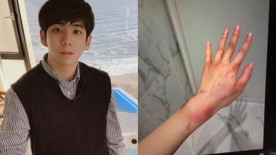 JISOO親哥老婆疑遭家暴！友人親筆信作證：被打到體無完膚