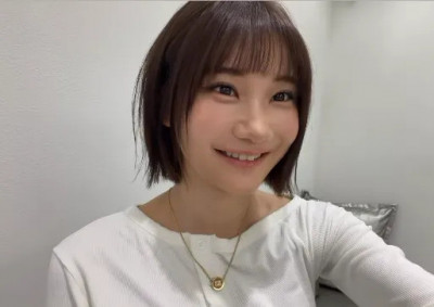 拒當女版胡瓜！愛莉莎莎割雙眼皮 「修復成果」曝光：這兩個月不敢見人