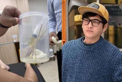42歲歌手黃靖倫膝蓋積水 驚曝抽水有點痛