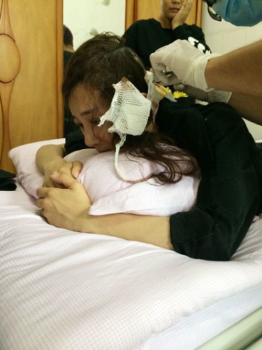 李依曉耳朵、頭部被咬得血肉模糊,送醫後後腦勺縫了20多針,耳朵也被撕爛,看了令人怵目驚心。
(圖擷取自微博) 李依曉耳朵、頭部被咬得血肉模糊,送醫後後腦勺縫了20多針,耳朵也被撕爛,看了令人怵目驚心。
(圖擷取自微博)