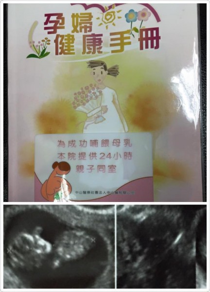 麥升陽po出寶寶的超音波照。(取自麥升陽臉書) 麥升陽po出寶寶的超音波照。(取自麥升陽臉書)