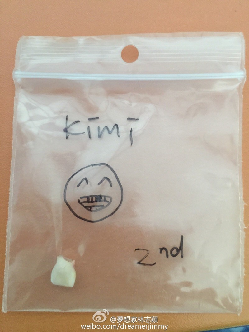 林志穎兒子kimi又掉了顆牙。（取自微博）