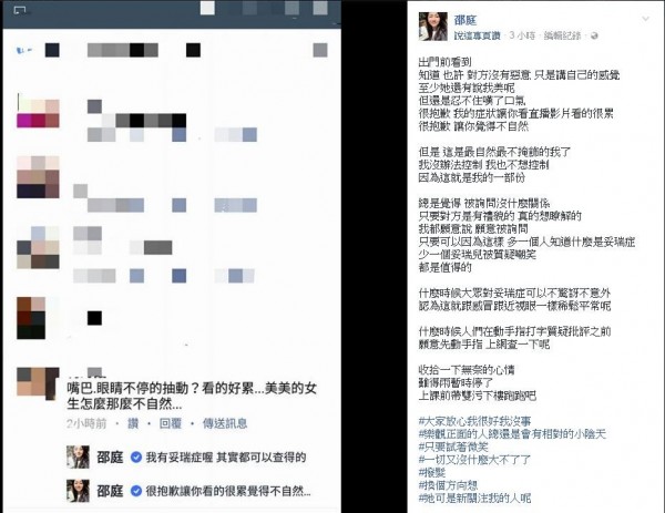 近日有網友看了邵庭的直播指表情不自然,邵庭在臉書上PO文表示自己患有委瑞氏症。(圖擷取自臉書) 近日有網友看了邵庭的直播指表情不自然,邵庭在臉書上PO文表示自己患有委瑞氏症。(圖擷取自臉書)