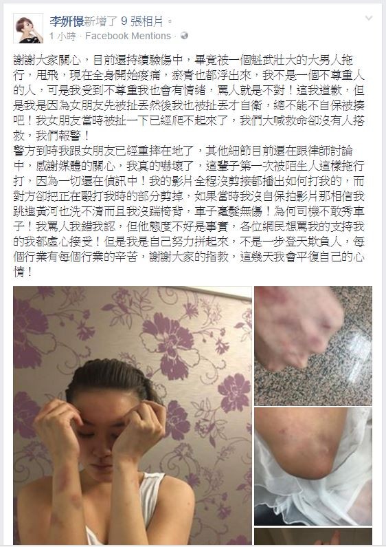 傍晚5時多,李妍憬在臉書發文感謝大家關心,並表示現在全身開始痠痛,瘀青也都浮出來。(圖擷取自李妍憬臉書) 傍晚5時多,李妍憬在臉書發文感謝大家關心,並表示現在全身開始痠痛,瘀青也都浮出來。(圖擷取自李妍憬臉書)