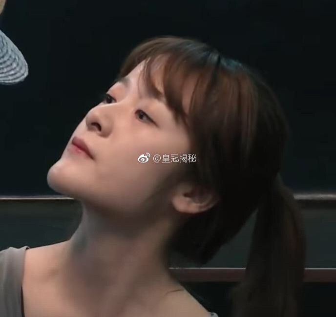 徐嬌的下巴似乎有些不自然。（翻攝自微博）
