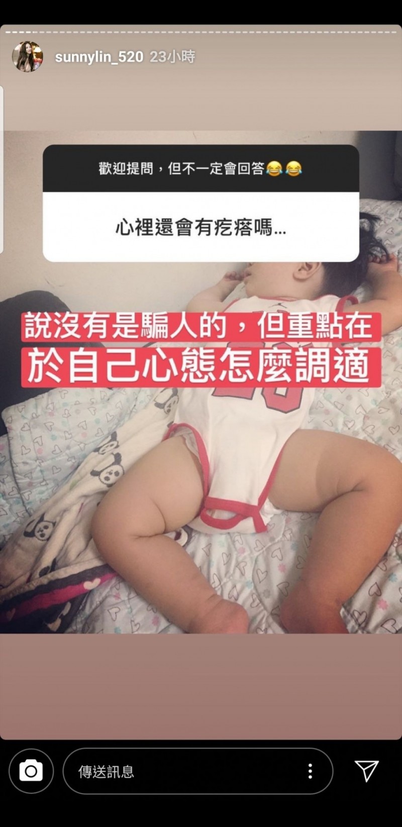 林采緹在限時動態接受網友提問。（翻攝自IG）