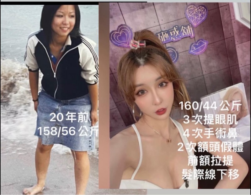 雪碧公開沒整形前的模樣。（翻攝自臉書）