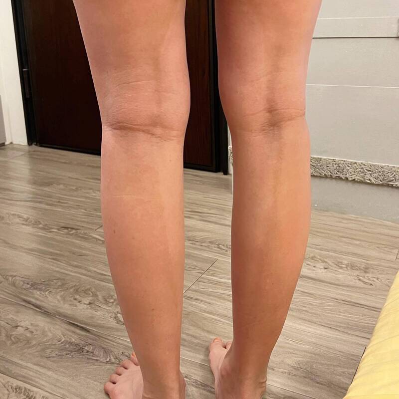 趙小僑懷孕後曝光身體出現二變化。（翻攝自臉書）