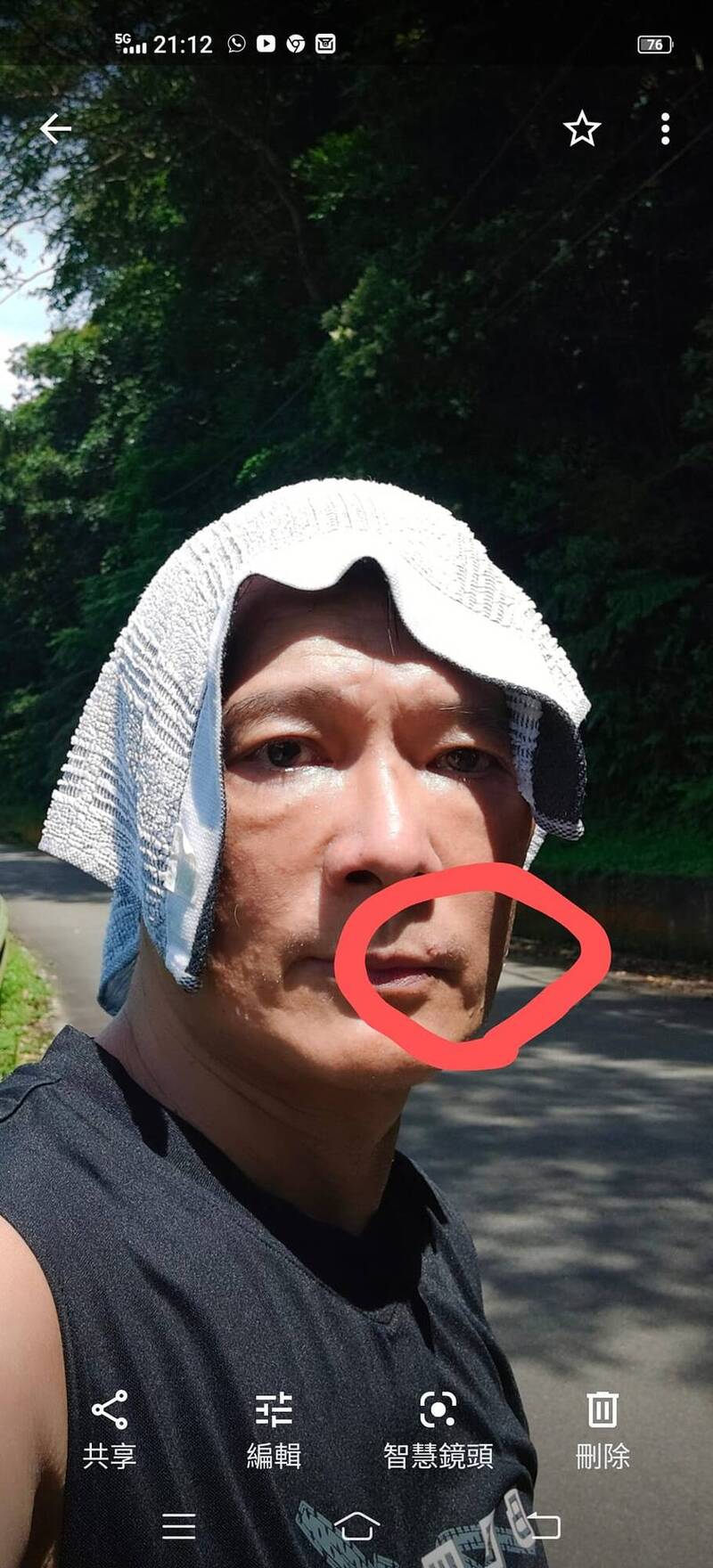 蔡詩萍公開自拍照，表示嘴角長出幾粒小痘子。（翻攝自臉書 蔡詩萍）