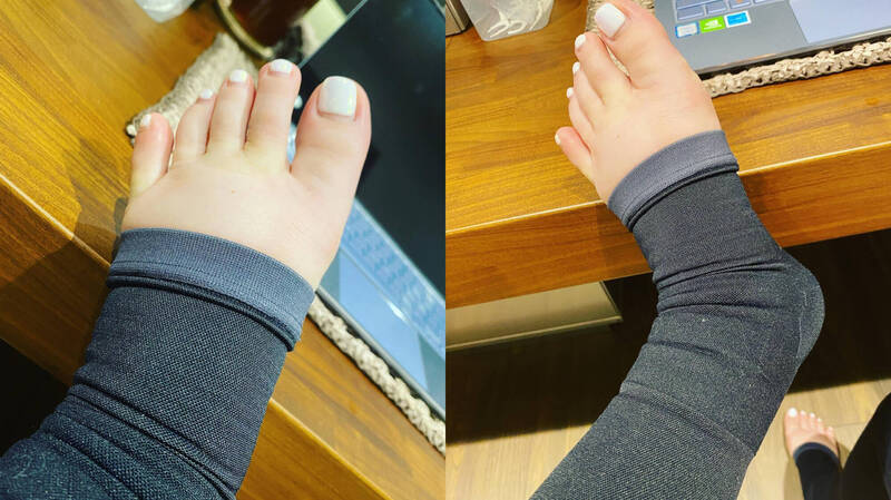 張齡予飽受末梢神經水腫所苦。(翻攝自FB)