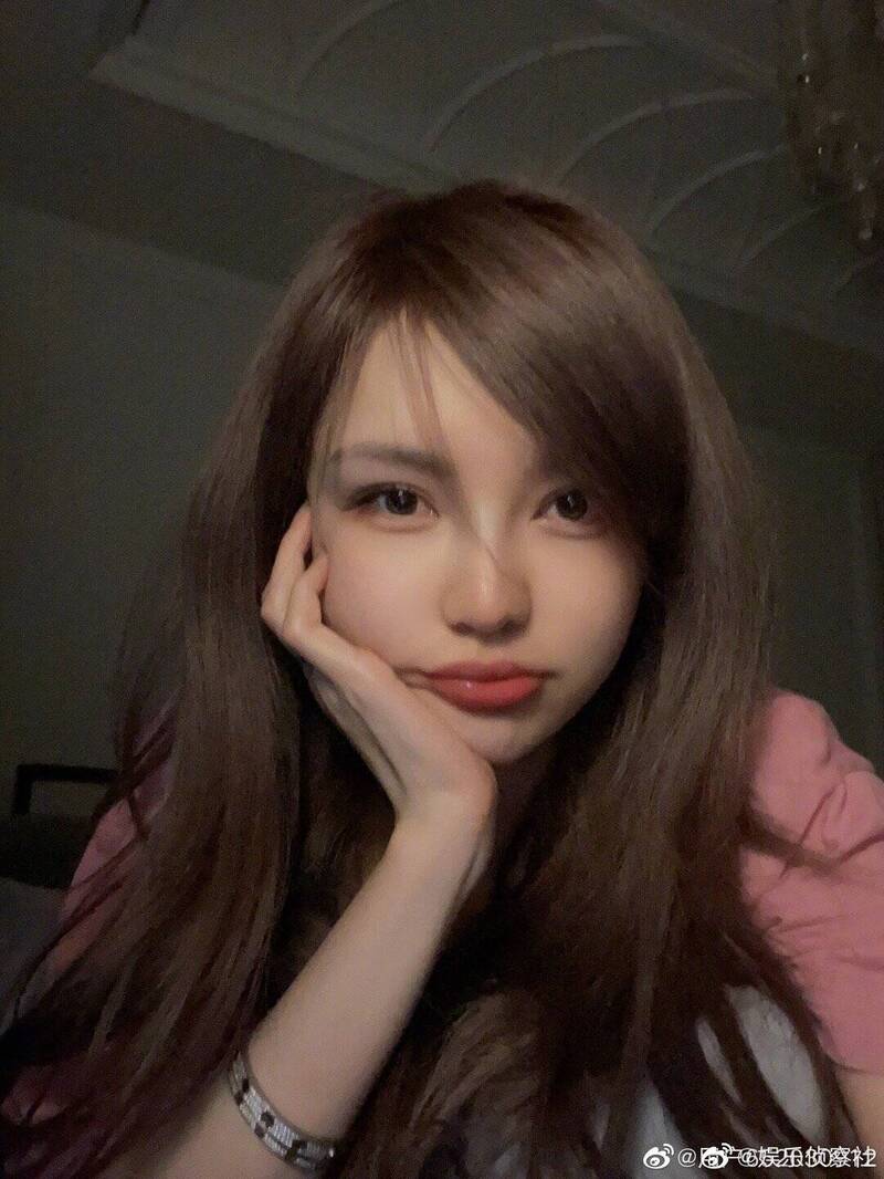 才臉腫卡海關...周揚青突曬自拍嚇壞人 - 自由娛樂