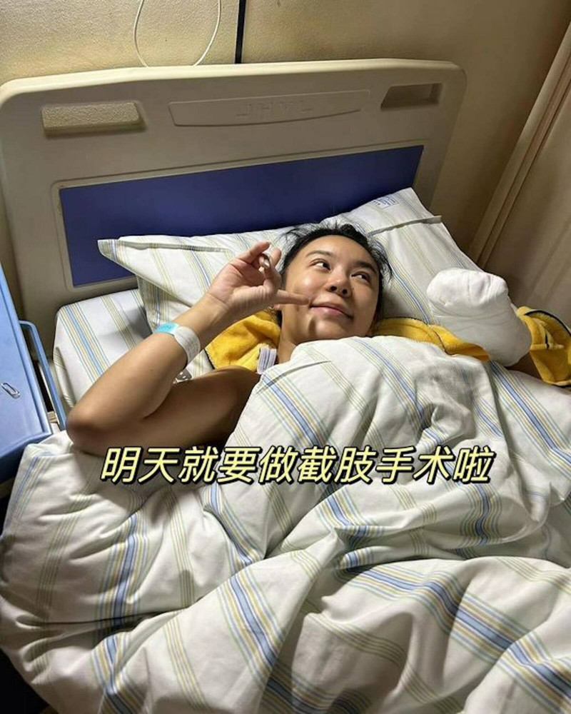 杜顏嘉發生事故，左手進行截肢手術。（翻攝自IG）