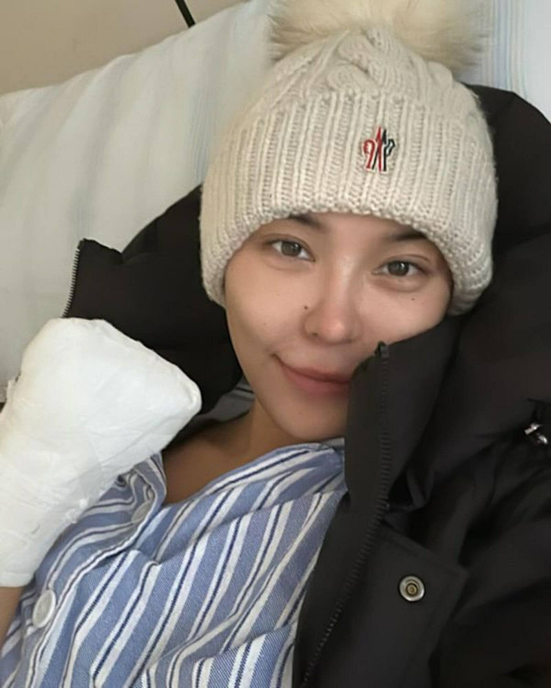 杜顏嘉發生事故，左手進行截肢手術。（翻攝自IG）