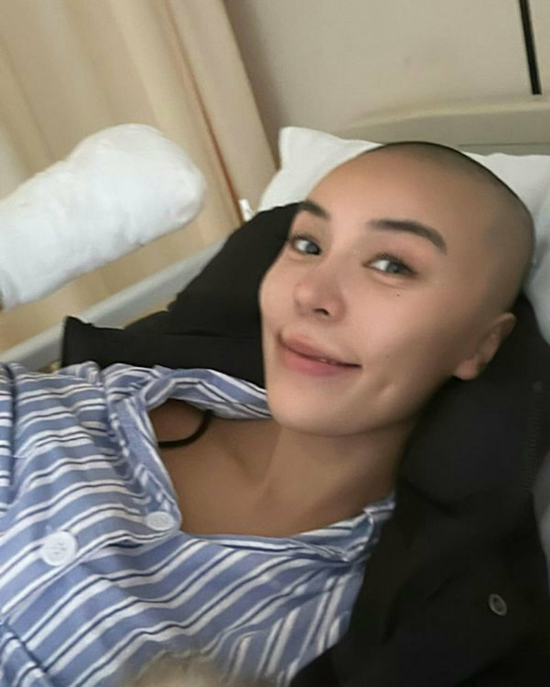 杜顏嘉發生事故，左手進行截肢手術。（翻攝自IG）