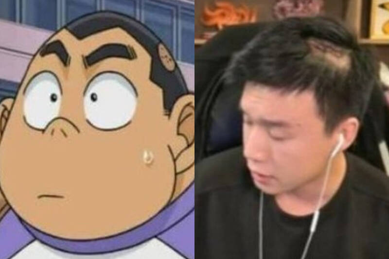 台灣,|Toyz頭部超大撕裂傷變禿頭！  竟撞臉《名偵探柯南》元太 - 自由娛樂