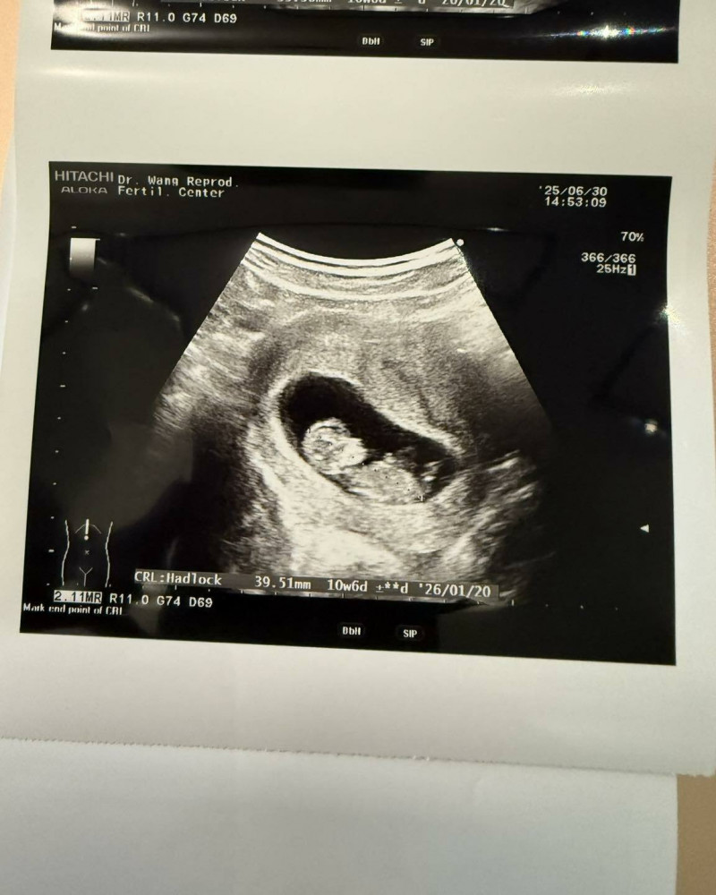 嚴爵在父親節秀出超音波照片，老婆終於懷孕了。（翻攝自臉書）