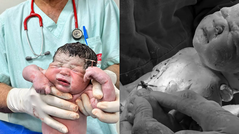 巴西這名男嬰左手握著媽媽的避孕器，右圖經過顏色處理。（翻攝自IG）