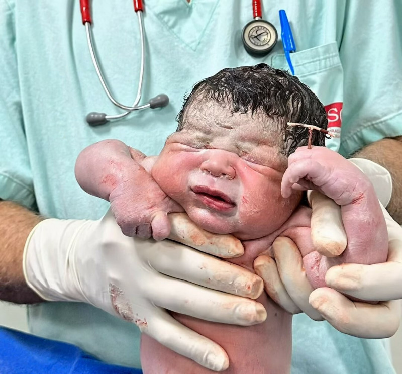 攔不住我!新生兒手握媽媽避孕器 戰勝99%避孕率誕生