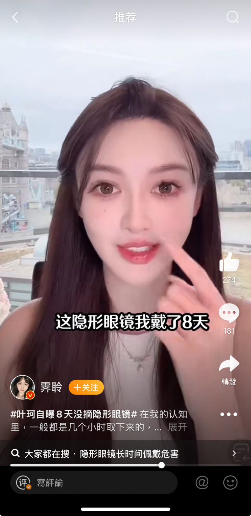 葉珂自爆連戴8天隱形眼鏡。（翻攝自微博）