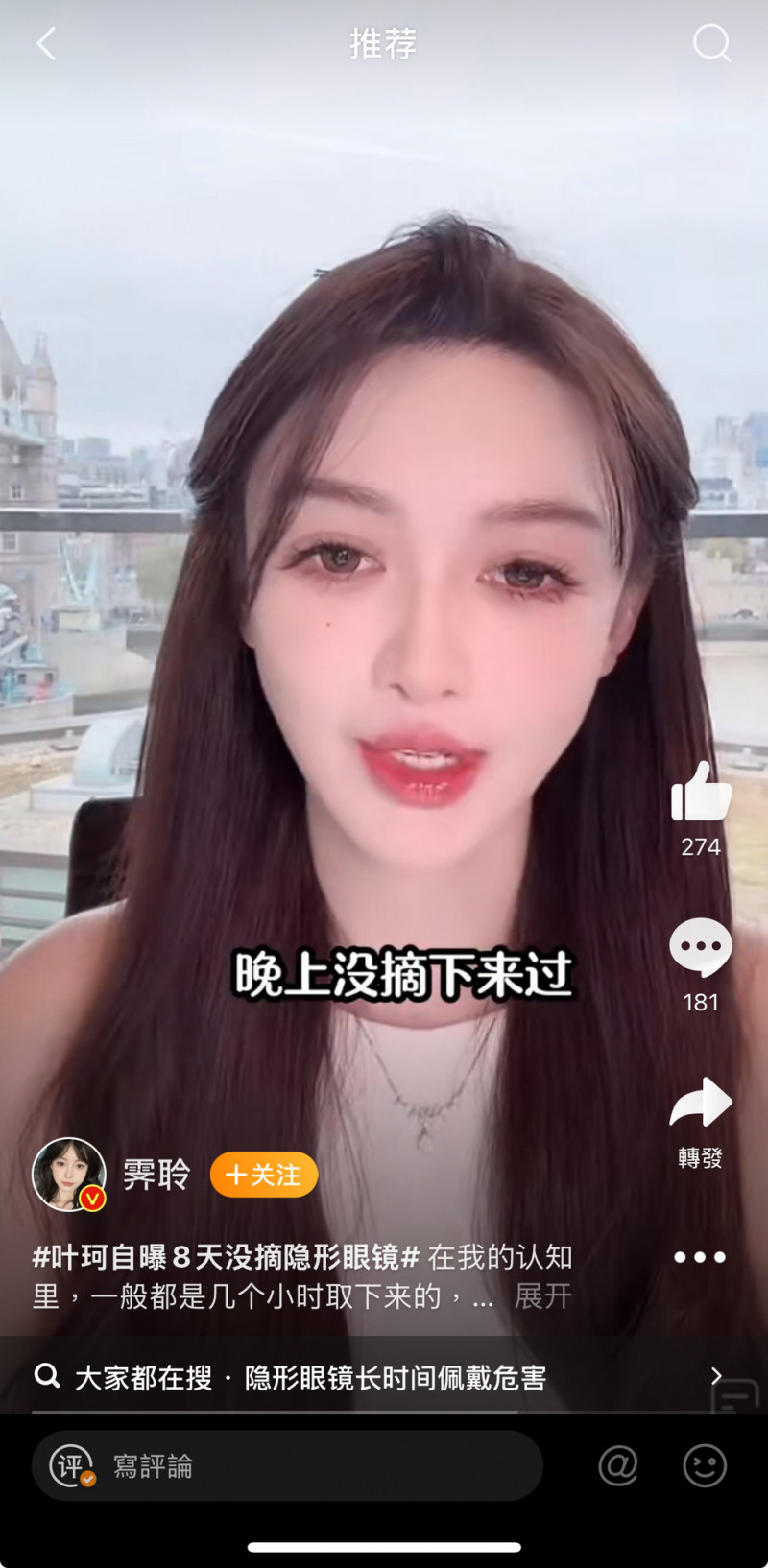 葉珂自爆連戴8天隱形眼鏡。（翻攝自微博）