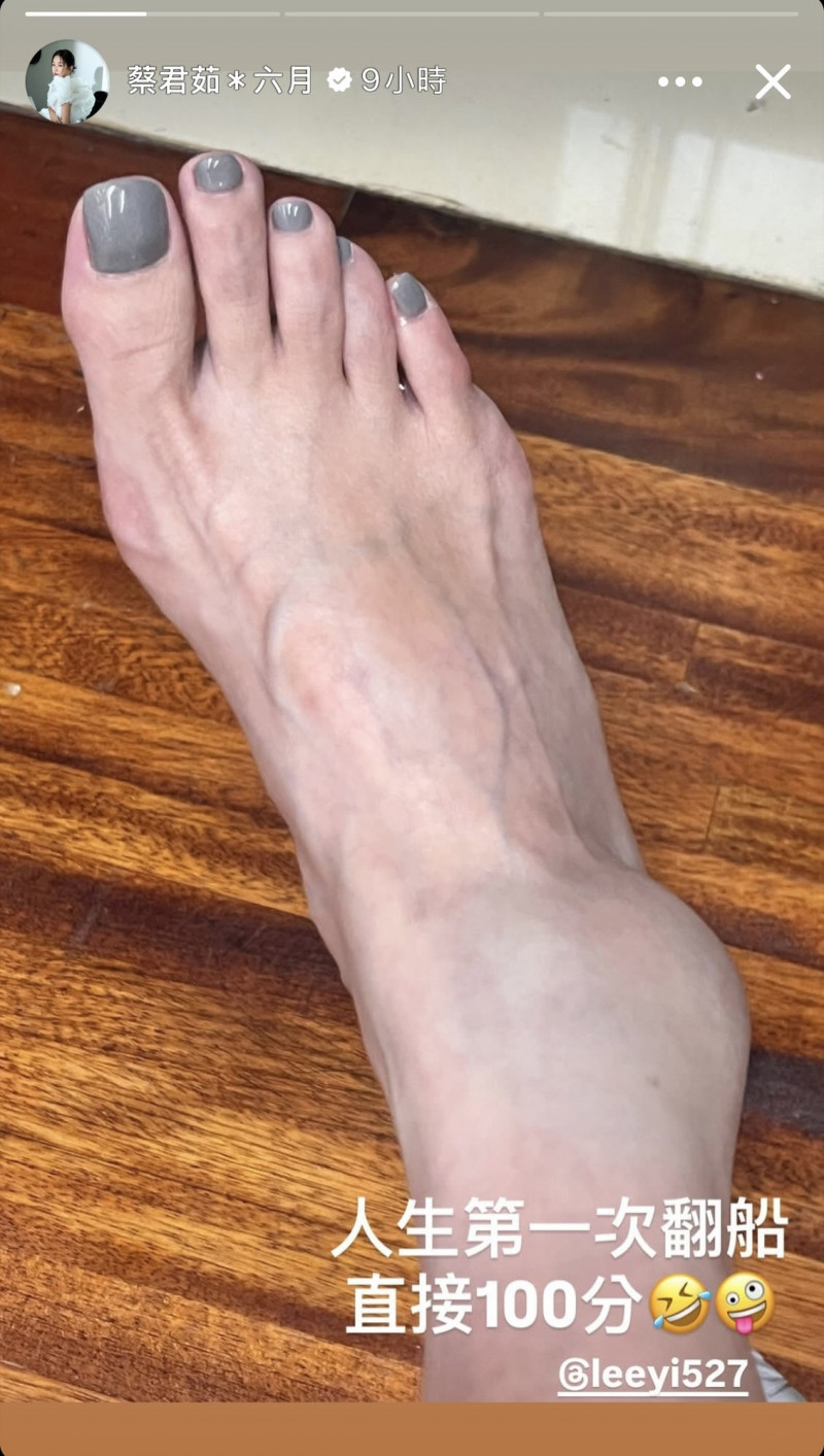 六月分享受傷照。（翻攝自IG）