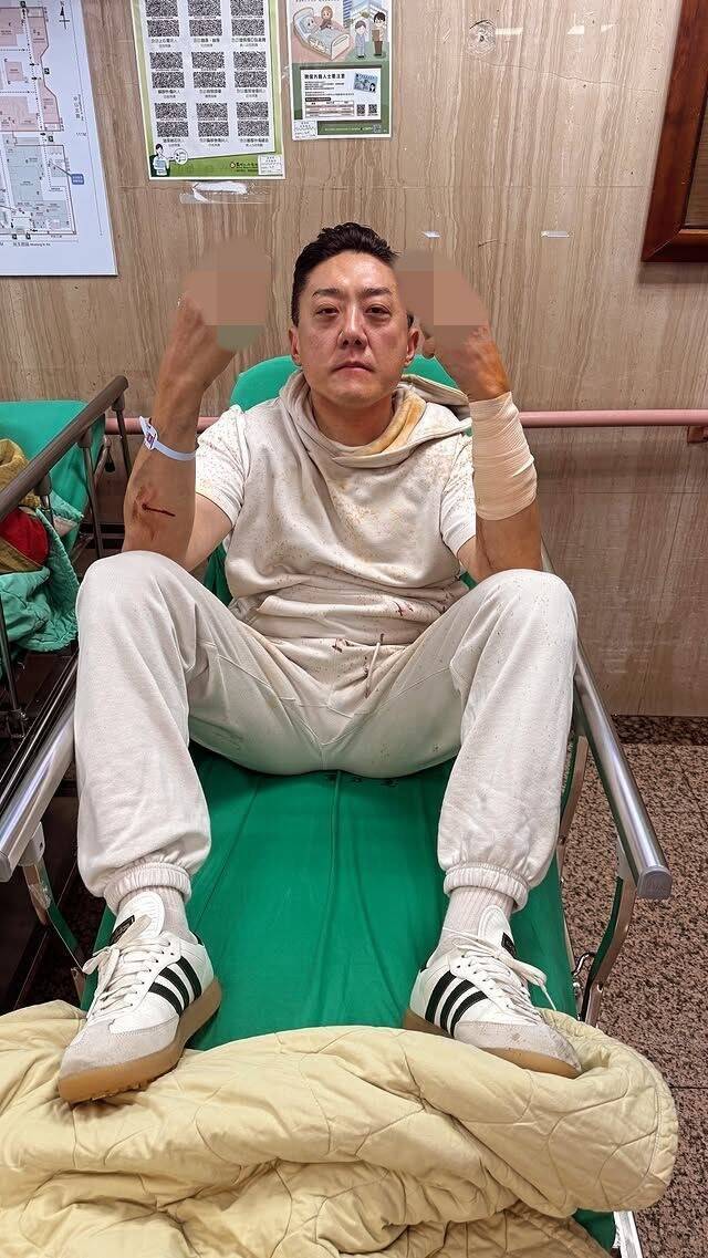 夏天倫日前在台北市民生東路三段的地下停車場遭人砍傷。（翻攝自IG）