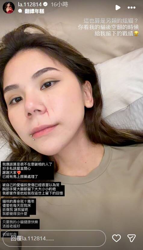 蕾菈指著自己臉上的傷痕笑稱是貓咪後空翻的時候留下戰績。（翻攝自IG）
