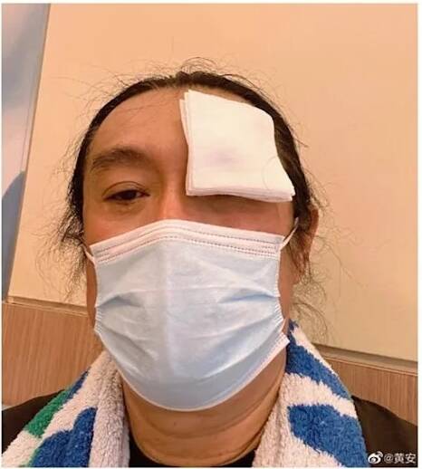 黃安眼疾立刻從中國飛回台灣爽用健保。（翻攝自微博）