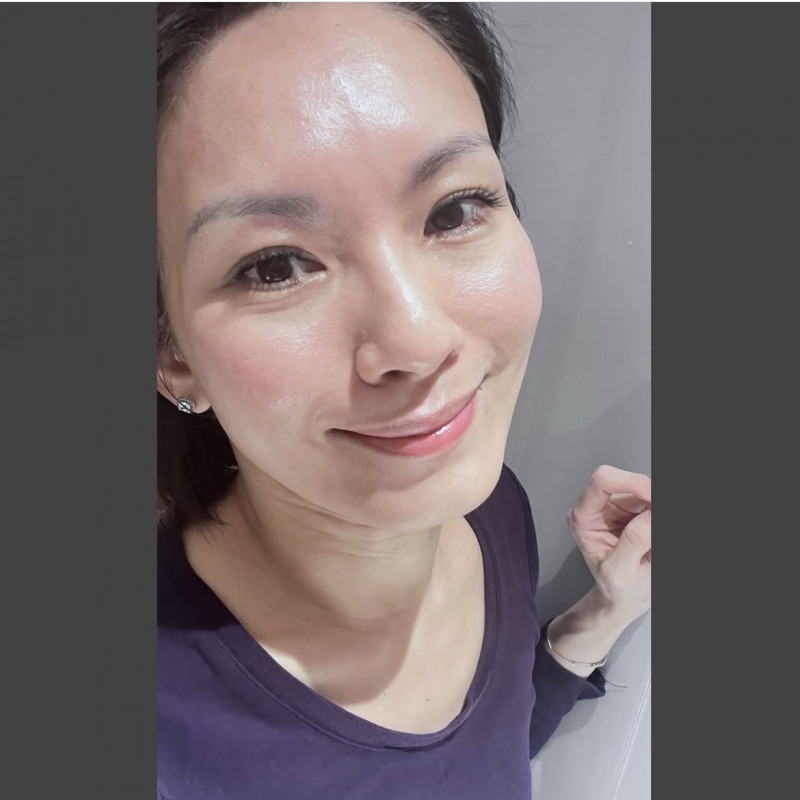 林佳儀素顏入鏡。（翻攝自IG）