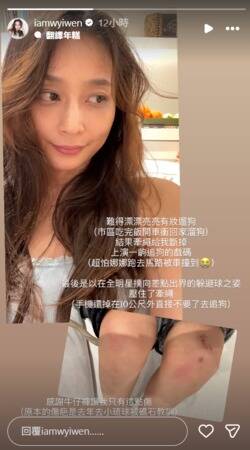 文雨非原想美美遛狗，卻因牽繩斷裂意外慘摔。（翻攝自IG）