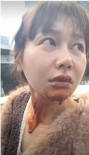 王添羽模仿網路「噴火蛋糕」卻遭火苗反撲，迅速赴醫急救。（圖／翻攝自微博