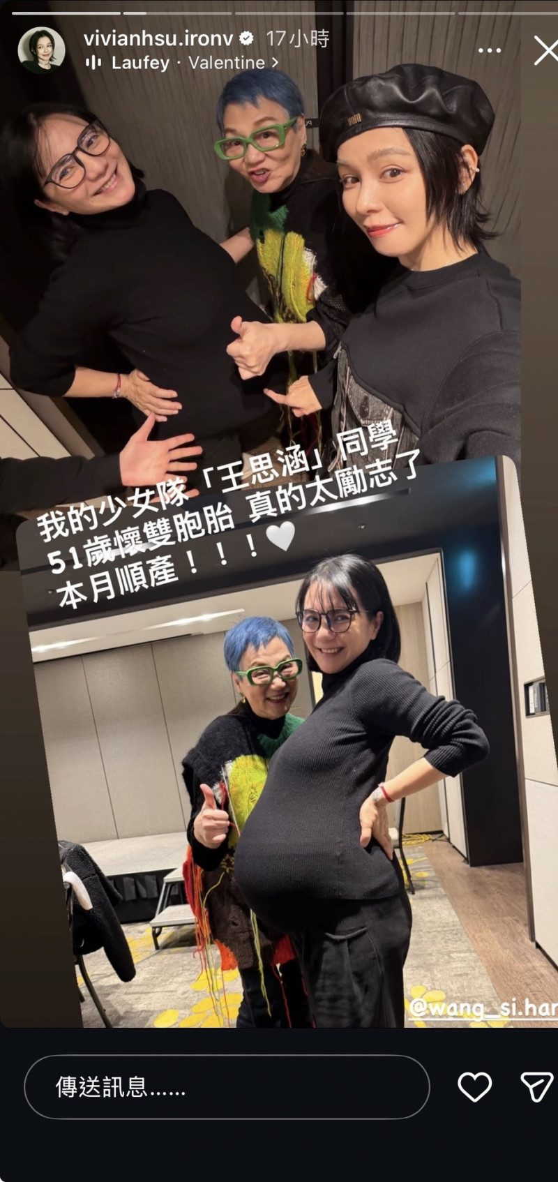 50歲少女隊成員喜懷雙胞胎本月順產 徐若瑄發聲：太勵志了