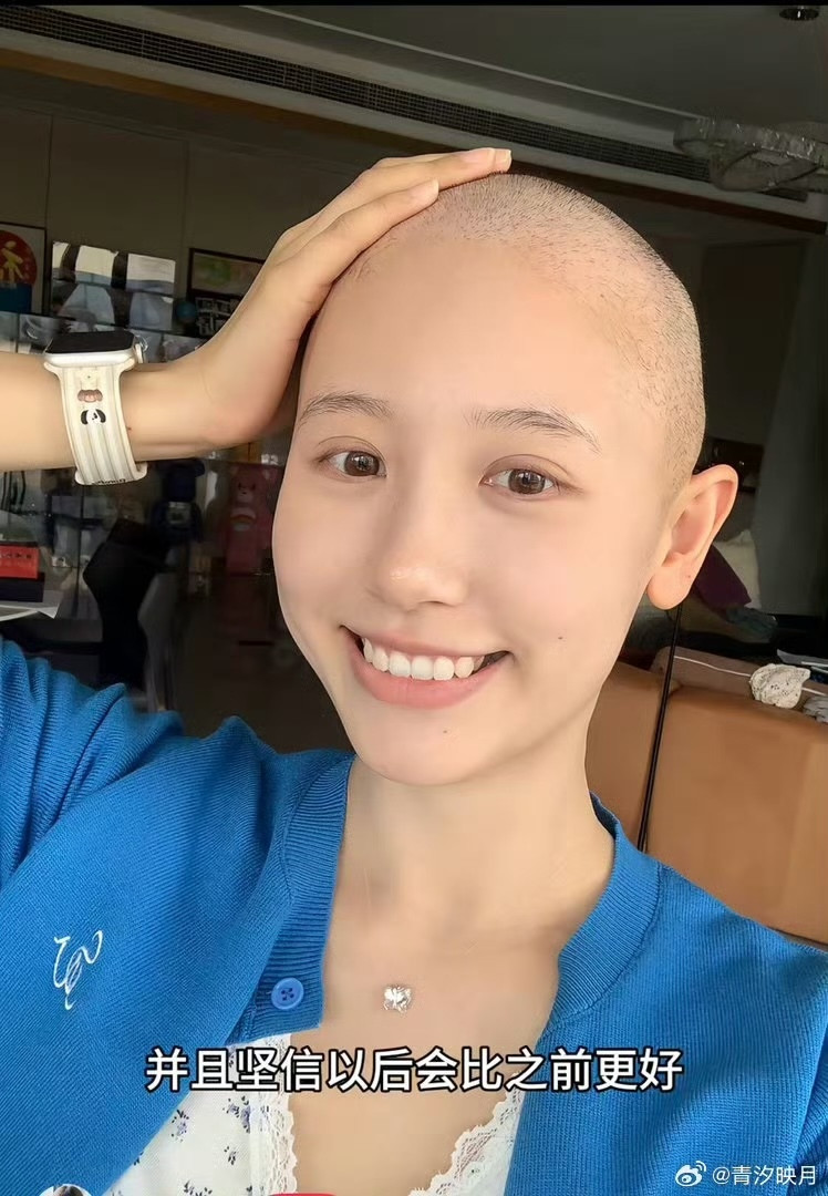 千萬網紅驚傳罹癌三期「心碎落髮」抗癌 嫩尪深情陪剃光頭...網讚：這才是真男人
