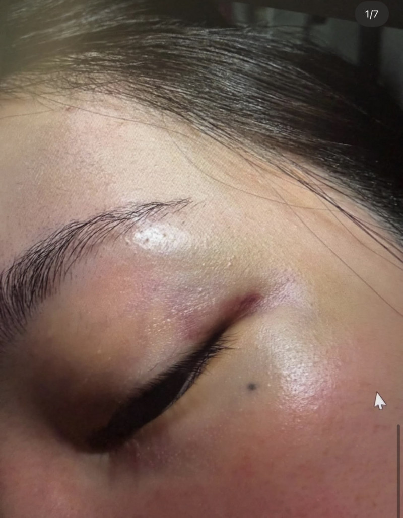 JISOO親哥疑似家暴老婆，傷痕累累。（翻攝自theqoo）