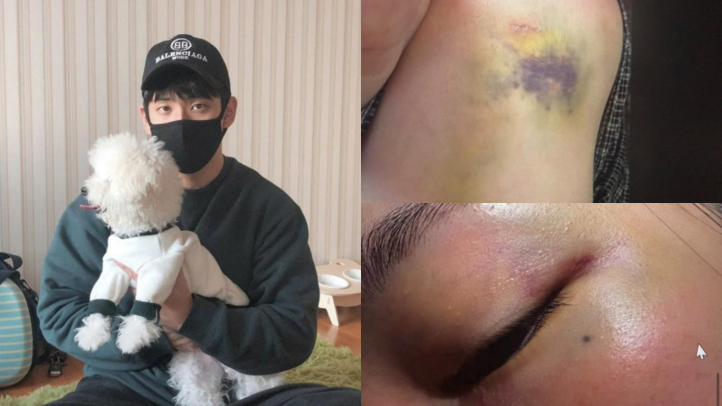 JISOO親哥爆家暴！老婆驚悚傷勢照曝光：被迫吞X硬上後門