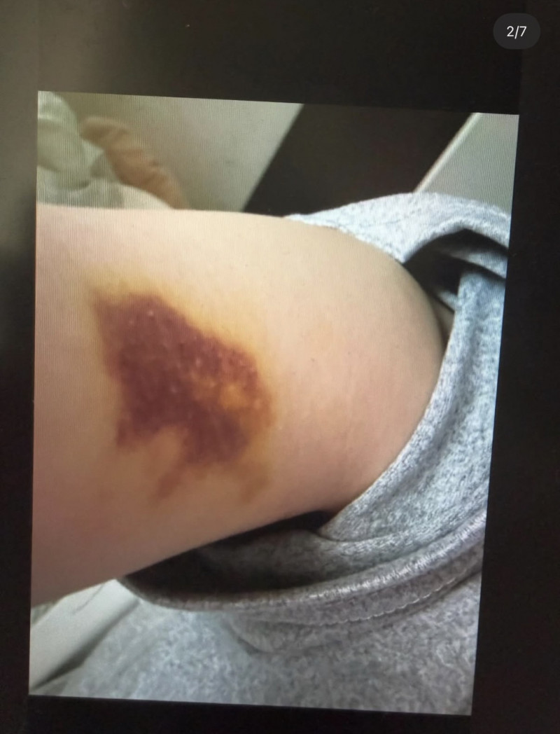 JISOO大嫂疑似全身是傷。（翻攝自theqoo）