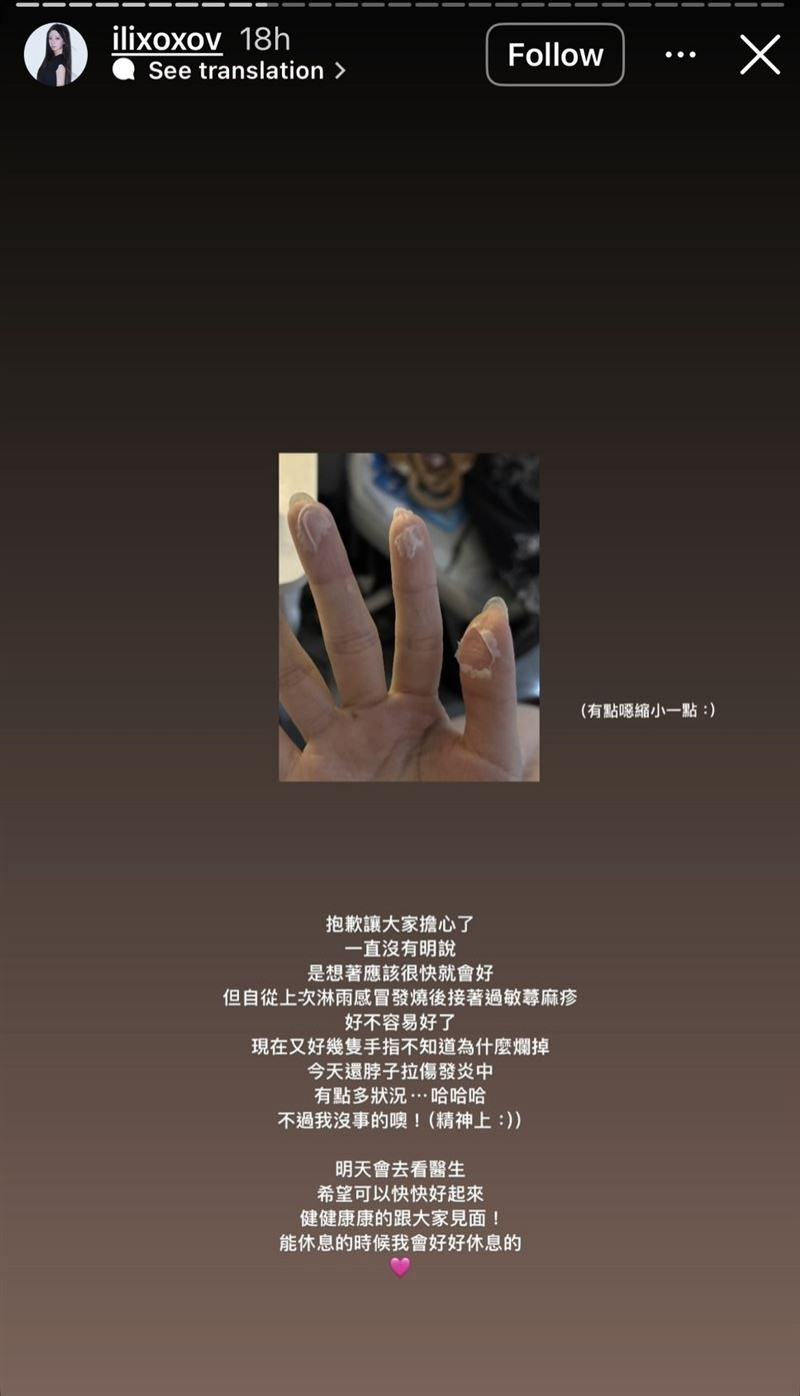 一粒在限時動態秀出自己爛掉的手指頭。（翻攝自IG）