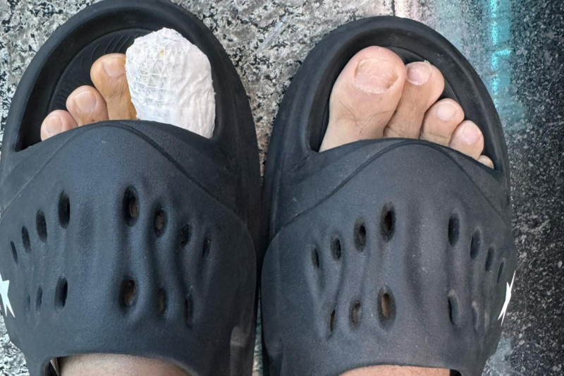 小馬才爆兄弟反目 又傳受傷見血 腳趾骨裂照曝光