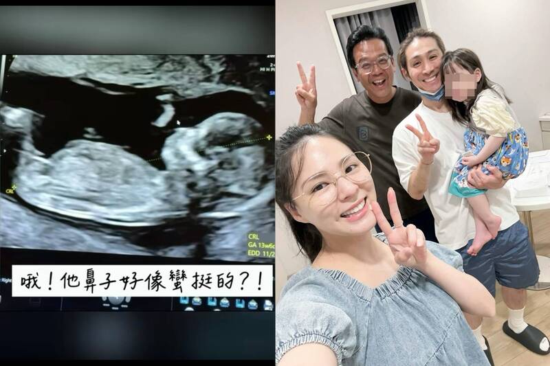 熊熊二寶性別揭曉!超音波驚見「挺鼻神複製」