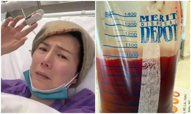 前港姐吳文忻乳癌復發苦撐3年 最後露面畫面令人鼻酸