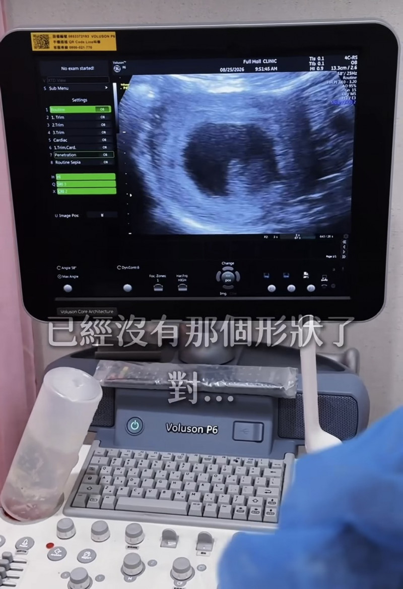 李宓遺憾告別六寶。（翻攝自IG）