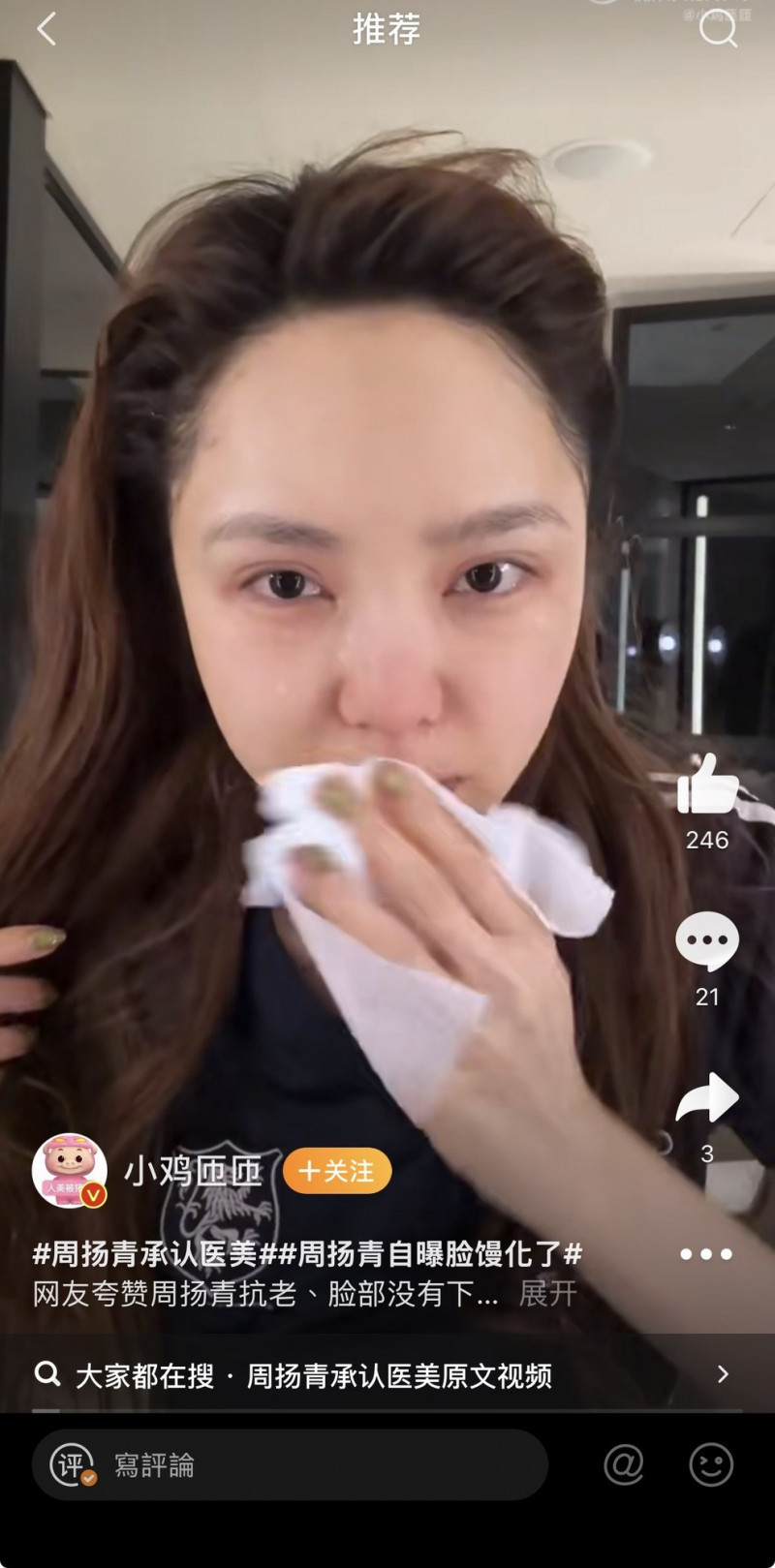 周揚青自曝出現「饅化」狀態。（翻攝自微博）